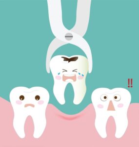 Dental extraction services