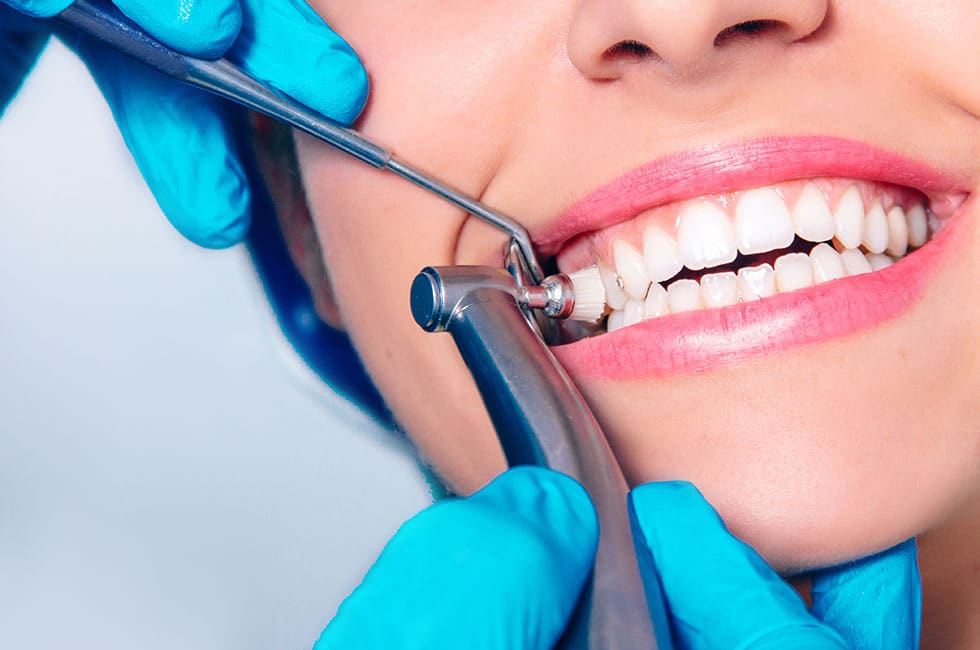 Dental Cleaning Services